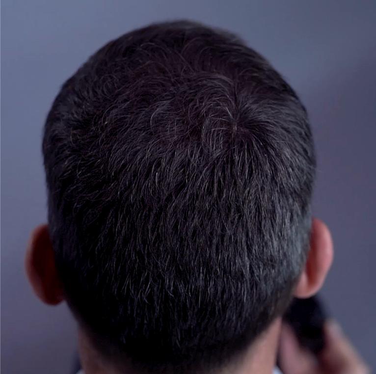 Haar gevuld met haarvezels