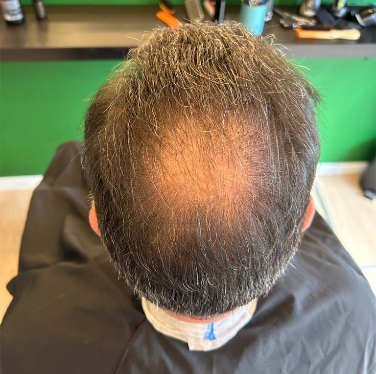 Haar ongevuld zonder haarvezels 2