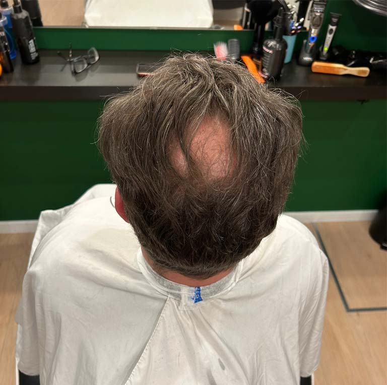 Haar gevuld met haarvezels 2