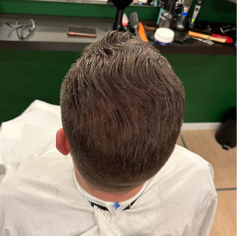 Haar gevuld met haarvezels 2