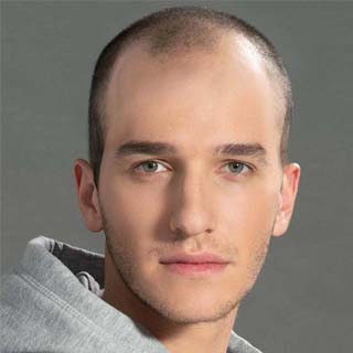 Haar man zonder haarwerk